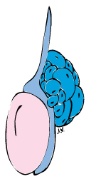 verschillende cystes vormen een multiloculaire bijbalcyste